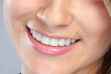 Dobro je znati::Informacije koje mogu pomoći da sačuvate zdrave zube Dobro je znati